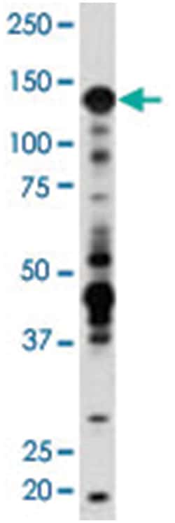 IGF1R Rabbit anti-Human, Polyclonal Antibody, Abnova 400 &mu;L | Buy Online | Abnova Corporation | Fisher Scientific