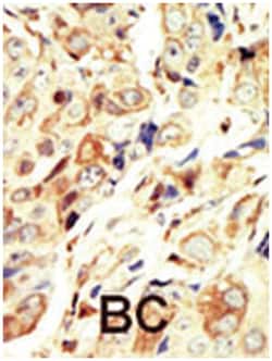 IGF1R Rabbit anti-Human, Polyclonal Antibody, Abnova 400 &mu;L | Buy Online | Abnova Corporation | Fisher Scientific