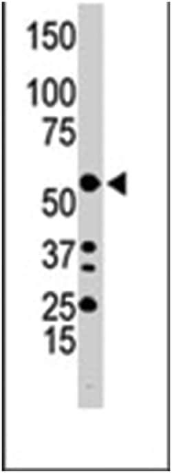 ILK Rabbit anti-Human, Polyclonal Antibody, Abnova 400 &mu;L | Buy Online | Abnova Corporation | Fisher Scientific