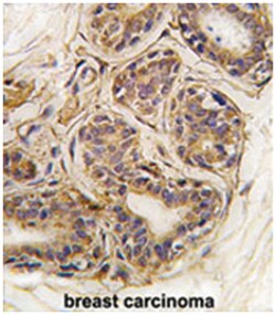 CASC3, Rabbit, Polyclonal Antibody, Abnova 400&mu;L; Unlabeled:Anticuerpos