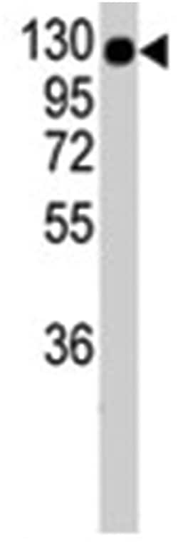 COL2A1 Rabbit anti-Human, Polyclonal Antibody, Abnova 400&mu;L; Unlabeled:Antibodies,