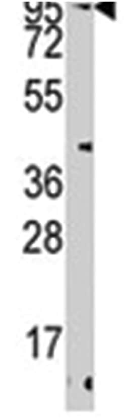 TRPV3 Rabbit anti-Mouse, Polyclonal Antibody, Abnova 400 &mu;L | Buy Online | Abnova Corporation | Fisher Scientific