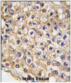 TRPV3 Rabbit anti-Mouse, Polyclonal Antibody, Abnova 400 &mu;L | Buy Online | Abnova Corporation | Fisher Scientific