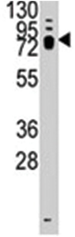 TRPV3 Rabbit anti-Human, Polyclonal Antibody, Abnova 400&mu;L; Unlabeled:Antibodies,