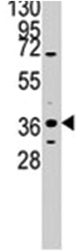 PITX2, Rabbit, Polyclonal Antibody, Abnova 400 &mu;L | Buy Online | Abnova Corporation | Fisher Scientific