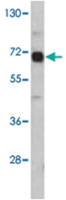 AFP Rabbit anti-Human, Polyclonal Antibody, Abnova 400 &mu;L | Buy Online | Abnova Corporation | Fisher Scientific