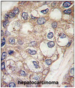 AFP Rabbit anti-Human, Polyclonal Antibody, Abnova 400 &mu;L | Buy Online | Abnova Corporation | Fisher Scientific