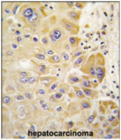 ALDH2, Rabbit, Polyclonal Antibody, Abnova 400 &mu;L | Buy Online | Abnova Corporation | Fisher Scientific