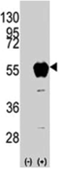 ALDH2, Rabbit, Polyclonal Antibody, Abnova 400 &mu;L | Buy Online | Abnova Corporation | Fisher Scientific