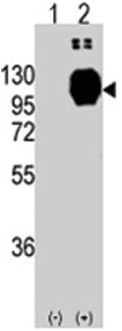 CDH13 Rabbit anti-Human, Polyclonal Antibody, Abnova 400 &mu;L | Buy Online | Abnova Corporation | Fisher Scientific