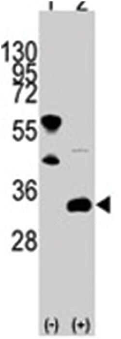 FRAT1 Rabbit anti-Human, Polyclonal Antibody, Abnova 400&mu;L; Unlabeled:Antibodies,