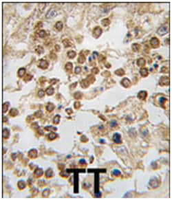 DPPA4 Rabbit anti-Human, Polyclonal Antibody, Abnova 400 &mu;L | Buy Online | Abnova Corporation | Fisher Scientific