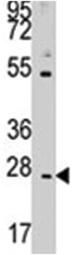 CD8B, Rabbit, Polyclonal Antibody, Abnova 400μL; Unlabeled:Antibodies,