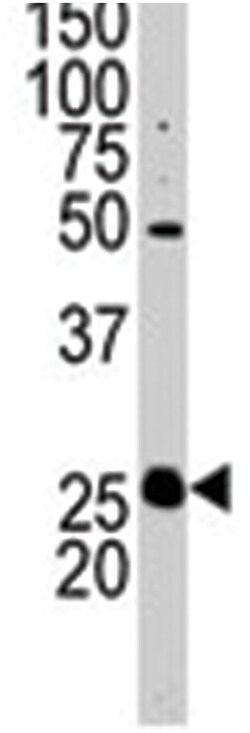 STC2 Rabbit anti-Human, Mouse, Polyclonal Antibody, Abnova 400 &mu;L | Buy Online | Abnova Corporation | Fisher Scientific