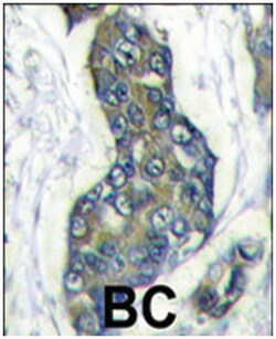 STC2 Rabbit anti-Human, Mouse, Polyclonal Antibody, Abnova 400 &mu;L | Buy Online | Abnova Corporation | Fisher Scientific