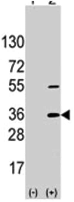 SSR1, Rabbit, Polyclonal Antibody, Abnova 400&mu;L; Unlabeled:Anticorps,