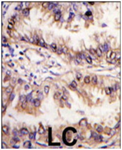 STK39 Rabbit anti-Human, Mouse, Polyclonal Antibody, Abnova 400&mu;L; Unlabeled:Antibodies,