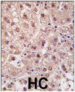 PSMA5 Rabbit anti-Human, Polyclonal Antibody, Abnova 400 &mu;L | Buy Online | Abnova Corporation | Fisher Scientific