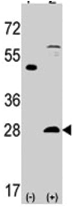 PSMA5 Rabbit anti-Human, Polyclonal Antibody, Abnova 400 &mu;L | Buy Online | Abnova Corporation | Fisher Scientific