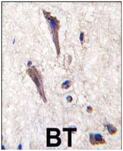 SPRED1 Rabbit anti-Human, Polyclonal Antibody, Abnova 400 &mu;L | Buy Online | Abnova Corporation | Fisher Scientific
