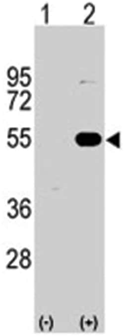 SPRED1 Rabbit anti-Human, Polyclonal Antibody, Abnova 400 &mu;L | Buy Online | Abnova Corporation | Fisher Scientific