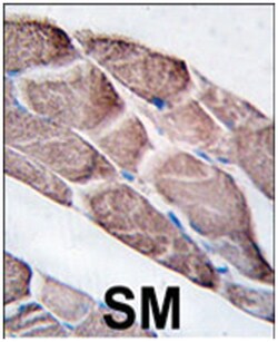 EPM2A Rabbit anti-Human, Polyclonal Antibody, Abnova 400&mu;L; Unlabeled:Antibodies,