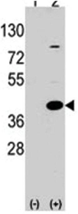 EPM2A Rabbit anti-Human, Polyclonal Antibody, Abnova 400&mu;L; Unlabeled:Antibodies,