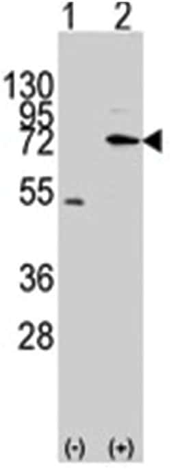 MIPEP Rabbit anti-Human, Polyclonal Antibody, Abnova 400 &mu;L | Buy Online | Abnova Corporation | Fisher Scientific
