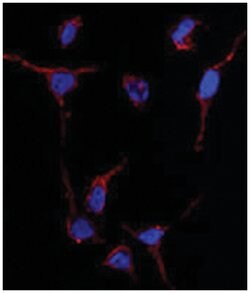 ALDH1A1 Rabbit anti-Human, Polyclonal Antibody, Abnova 400&mu;L; Unlabeled:Antibodies,