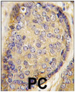 LXN, Rabbit, Polyclonal Antibody, Abnova 400&mu;L; Unlabeled:Antibodies,