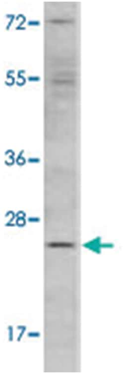 ERAS Rabbit anti-Human, Polyclonal Antibody, Abnova 400 &mu;L | Buy Online | Abnova Corporation | Fisher Scientific