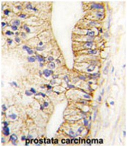 CDH7, Rabbit, Polyclonal Antibody, Abnova 400&mu;L; Unlabeled:Antibodies,