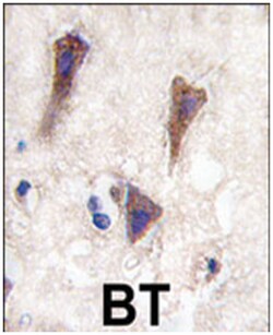 CDH12 Rabbit anti-Human, Polyclonal Antibody, Abnova 400μL; Unlabeled:Antibodies,