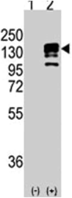 CDH1 Rabbit anti-Human, Mouse, Polyclonal Antibody, Abnova 400 &mu;L | Buy Online | Abnova Corporation | Fisher Scientific