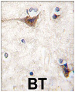 CDH10 Rabbit anti-Human, Polyclonal Antibody, Abnova 400 &mu;L | Buy Online | Abnova Corporation | Fisher Scientific