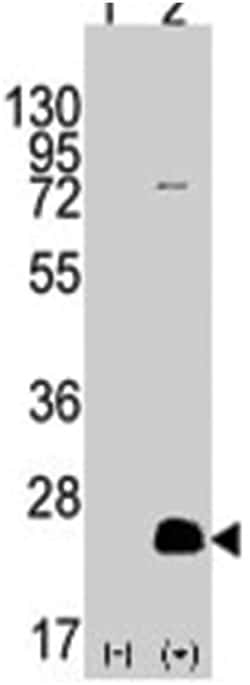 CD9 Rabbit anti-Human, Polyclonal Antibody, Abnova 400 &mu;L | Buy Online | Abnova Corporation | Fisher Scientific