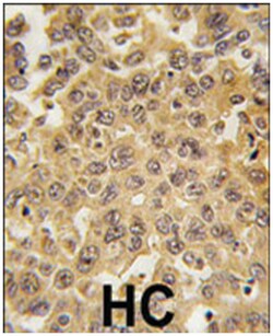 DDX3X Rabbit anti-Human, Polyclonal Antibody, Abnova 400&mu;L; Unlabeled:Anticuerpos