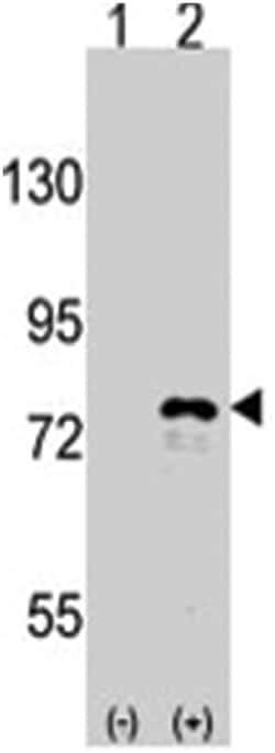 DDX3X Rabbit anti-Human, Polyclonal Antibody, Abnova 400&mu;L; Unlabeled:Anticuerpos