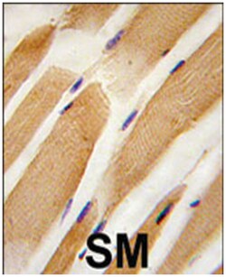 ACTB/ACTC1 Rabbit anti-Human, Polyclonal Antibody, Abnova 400 &mu;L | Buy Online | Abnova Corporation | Fisher Scientific
