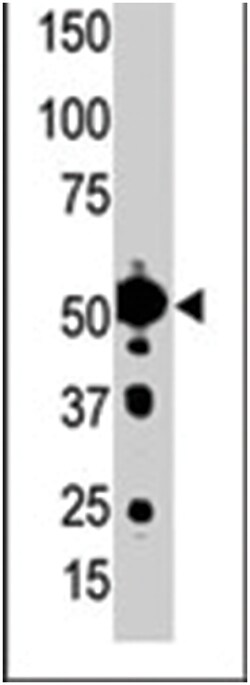 STK25 Rabbit anti-Human, Polyclonal Antibody, Abnova 400 &mu;L | Buy Online | Abnova Corporation | Fisher Scientific