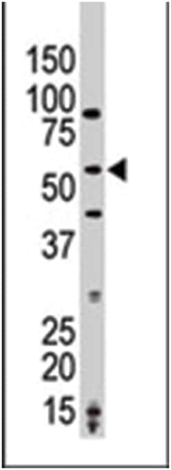 MAP3K8 Rabbit anti-Human, Polyclonal Antibody, Abnova 400 &mu;L | Buy Online | Abnova Corporation | Fisher Scientific