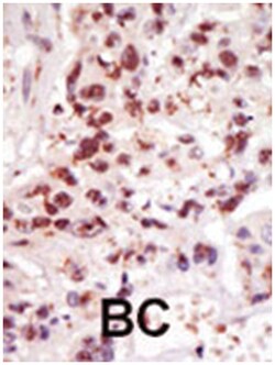 MAP3K8 Rabbit anti-Human, Polyclonal Antibody, Abnova 400 &mu;L | Buy Online | Abnova Corporation | Fisher Scientific