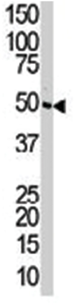 MAP2K2 Rabbit anti-Human, Mouse, Polyclonal Antibody, Abnova 400 &mu;L | Buy Online | Abnova Corporation | Fisher Scientific