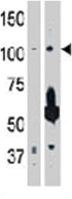 MAP3K14, Rabbit, Polyclonal Antibody, Abnova 400 &mu;L | Buy Online | Abnova Corporation | Fisher Scientific