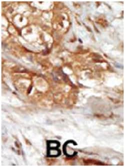 MAP3K14, Rabbit, Polyclonal Antibody, Abnova 400 &mu;L | Buy Online | Abnova Corporation | Fisher Scientific