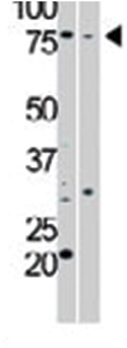 PRKG1, Rabbit, Polyclonal Antibody, Abnova 400 &mu;L | Buy Online | Abnova Corporation | Fisher Scientific