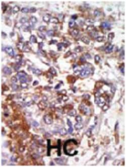 PRKG1, Rabbit, Polyclonal Antibody, Abnova 400 &mu;L | Buy Online | Abnova Corporation | Fisher Scientific