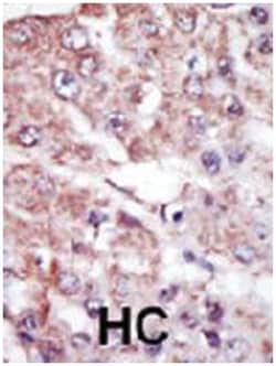 MARK2 Rabbit anti-Human, Mouse, Polyclonal Antibody, Abnova 400&mu;L; Unlabeled:Antibodies,