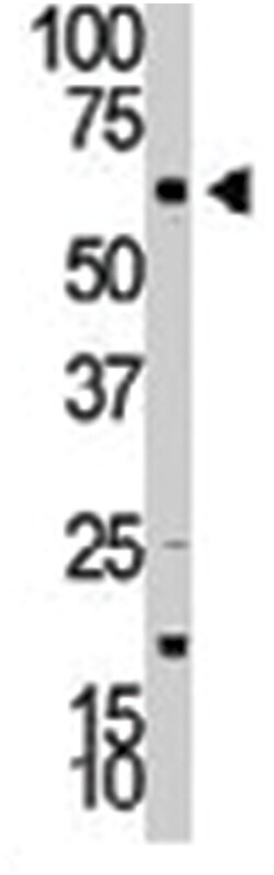 RPS6KB2 Rabbit anti-Human, Polyclonal Antibody, Abnova 400 &mu;L | Buy Online | Abnova Corporation | Fisher Scientific