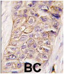 PIK3C2B, Rabbit, Polyclonal Antibody, Abnova 400&mu;L; Unlabeled:Antibodies,